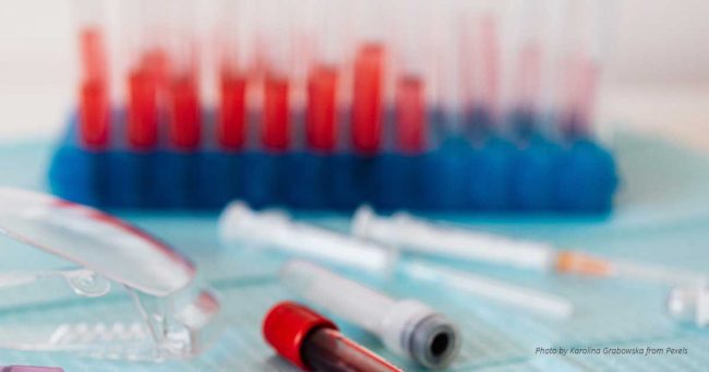 Bagaimana Jika Saya Memperoleh Hasil Tes HIV Palsu?