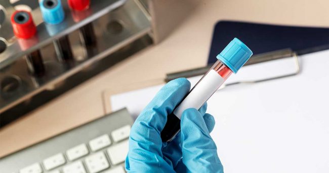 Mengapa Jumlah CD4 Tidak Meningkat?