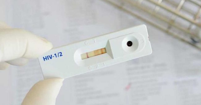 Tes HIV Mandiri, Perlu atau Tidak?