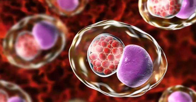 Waspada, Lima Infeksi Menular Seksual Ini Tidak Bergejala