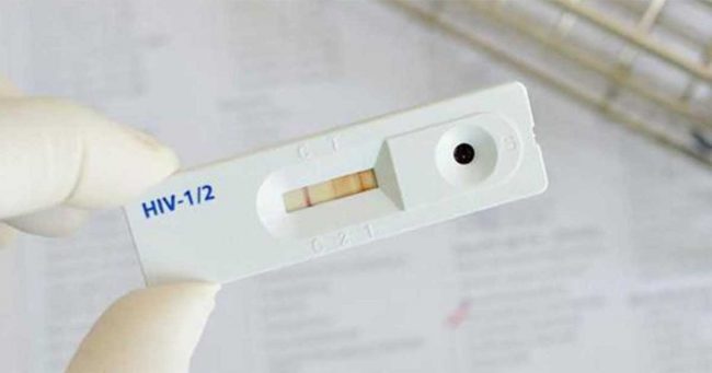 Tes HIV Mandiri akan Sia-Sia Jika Tidak Dilanjuti Dengan Pengobatan ARV