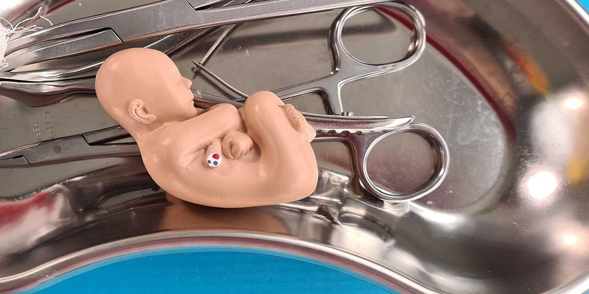 Let’s Talk About Abortion