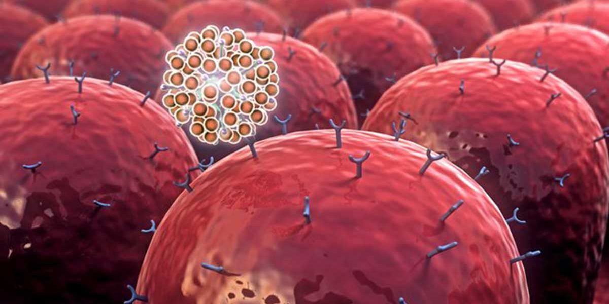 Apakah AIDS Sama Dengan Penyakit Autoimun? - Saya Berani
